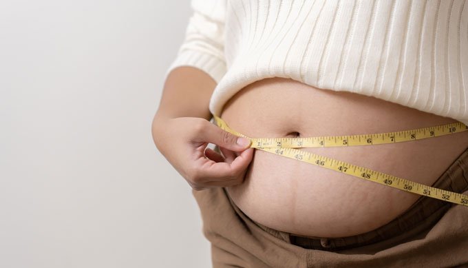 Obesity